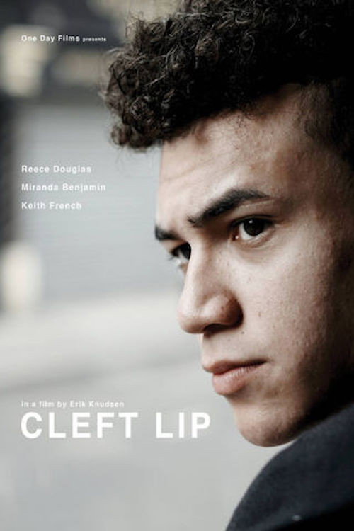 Cleft Lip постер