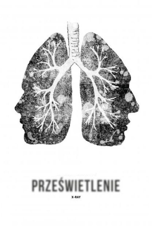 Prześwietlenie постер