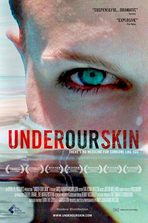 Under Our Skin постер