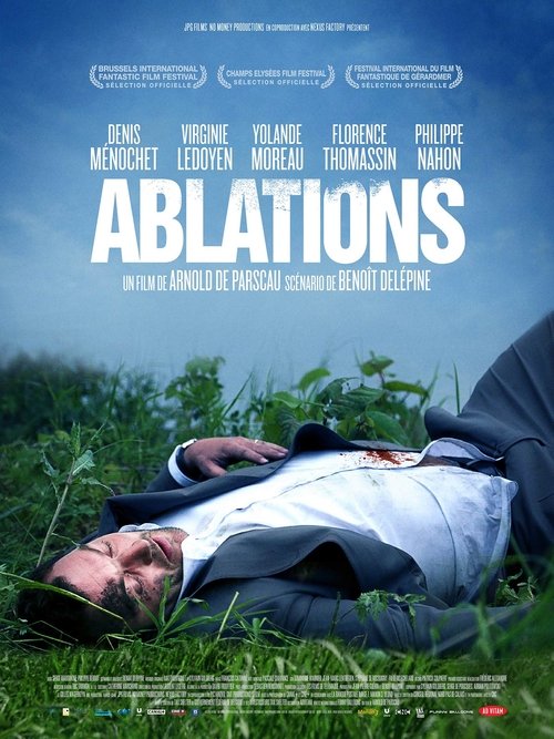 Ablations постер