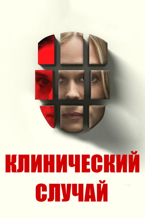 Клинический случай постер