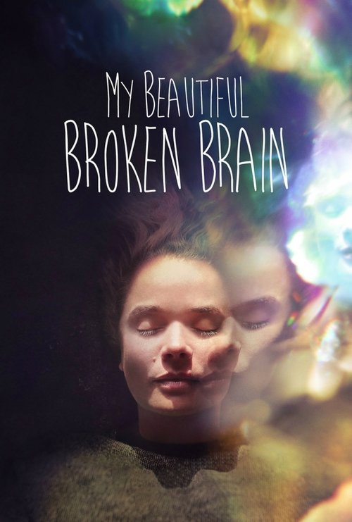 My Beautiful Broken Brain постер