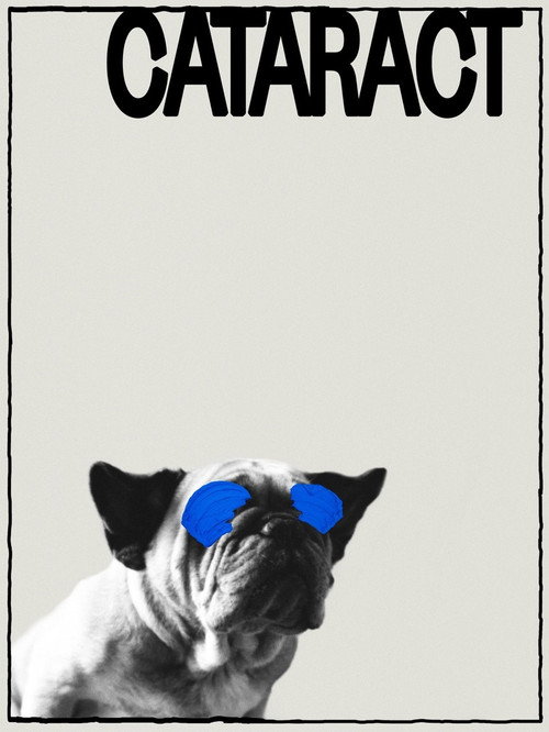 Катаракта постер