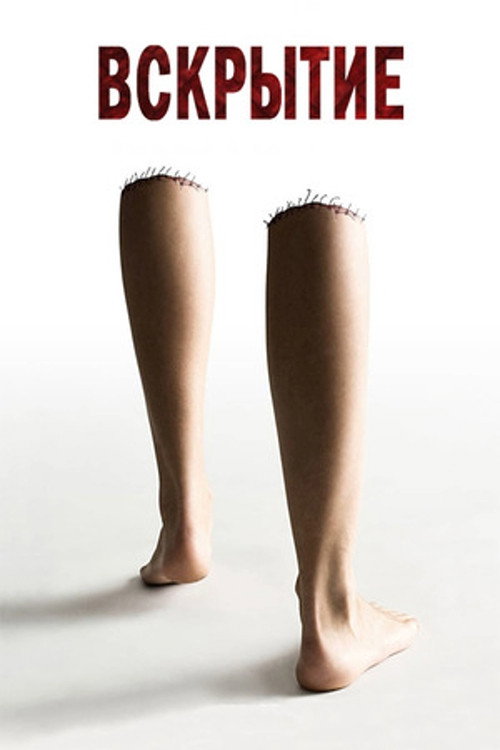 Вскрытие постер